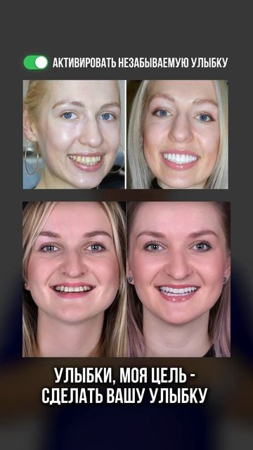Улыбка на ВСЮ жизнь от Артура!) Astra Dental Clinic смотреть онлайн