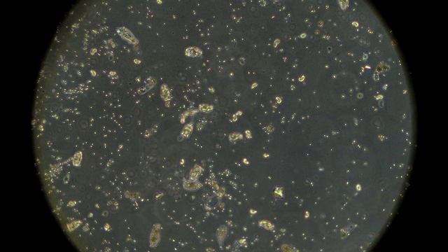 Вода из лесного озера под микроскопом MAGUS Bio V350 смотреть онлайн