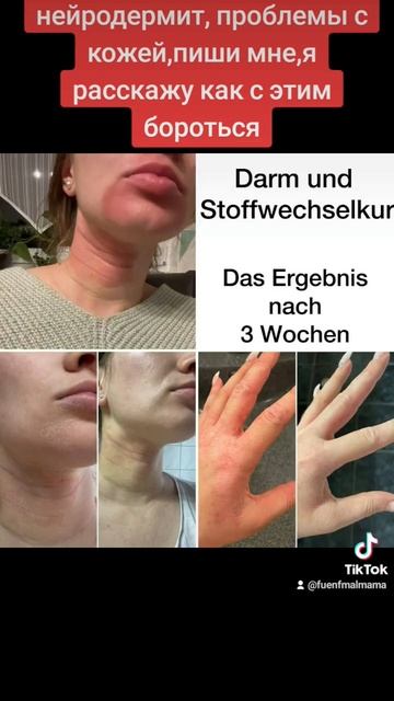 Не бегите к врачу с проблемой кожи, лечение надо начин? смотреть онлайн