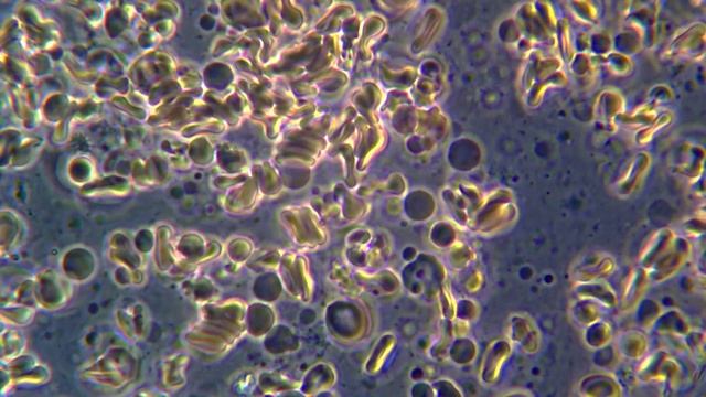 Кровь под микроскопом MAGUS Bio 270 смотреть онлайн