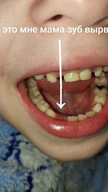 если честно вообще не больно (нет) смотреть онлайн