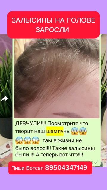 ЗАЛЫСИНЫ НА ГОЛОВЕ ЗАРОСЛИ смотреть онлайн