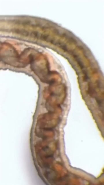 Паразиты в организме смотреть онлайн