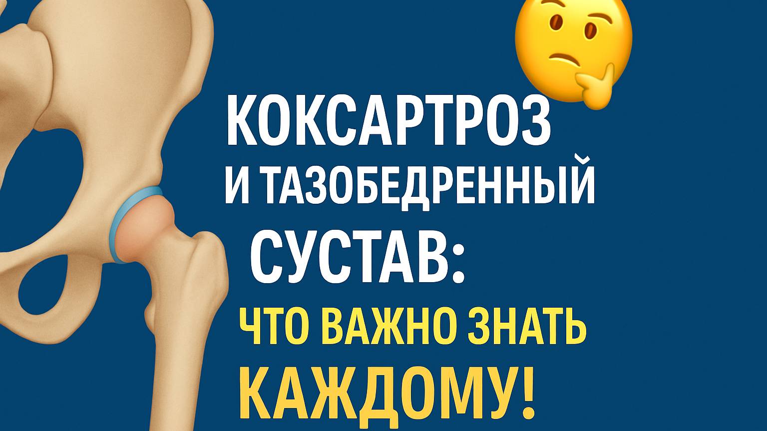 Коксартроз и тазобедренный сустав: что важно знать каждому! смотреть онлайн