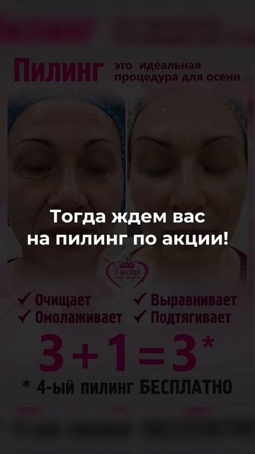 Акция на пилинг лица! 3+1=3, четвертый пилинг абсолютно б смотреть онлайн