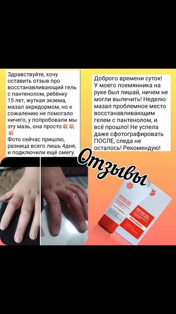 чудо-гель👍должен быть в аптечке у каждого☺ смотреть онлайн