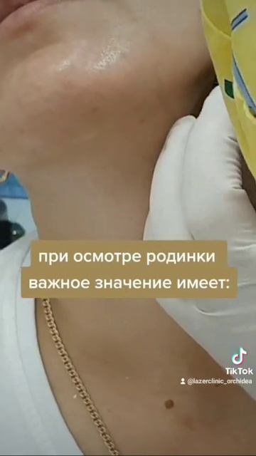 Обязательный осмотр родинок смотреть онлайн