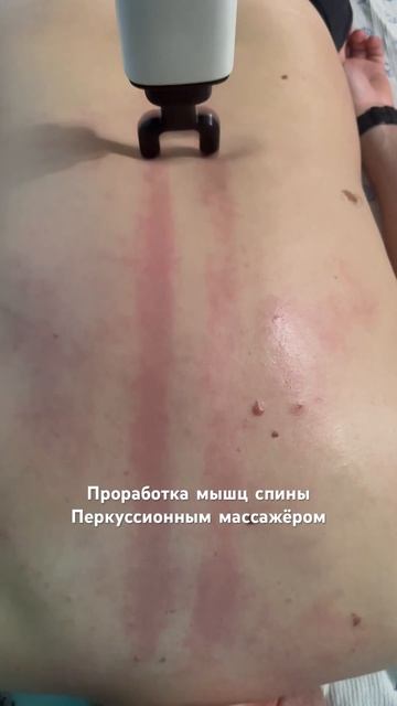 Перкуссионный массаж #массаж #релакс #кайф #здоровье смотреть онлайн