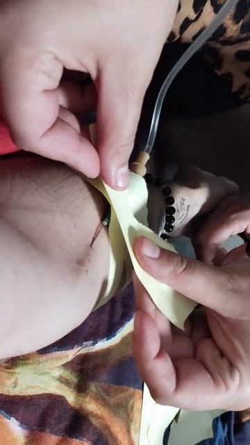 Ставлю капельницы от кишечной палочки, цистита и прос? смотреть онлайн