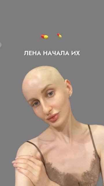 Что может быть причиной сильного выпадения волос? #вып смотреть онлайн