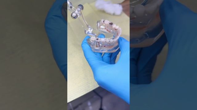 как помочь себе если болит зуб и в это время нету возмо смотреть онлайн