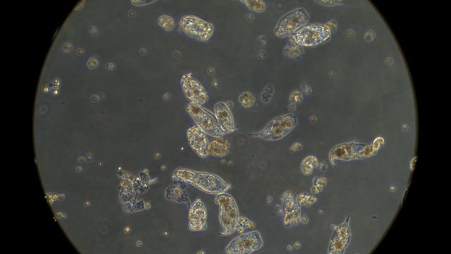 Вода из лесного озера под микроскопом MAGUS Bio V360 смотреть онлайн