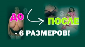 Редукционная маммопластика: что важно знать до операции — рассказывает хирург и пациентка