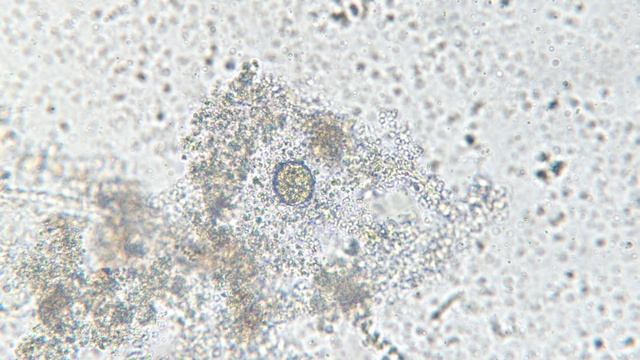 Вода из вазы под микроскопом MAGUS Bio V300 смотреть онлайн