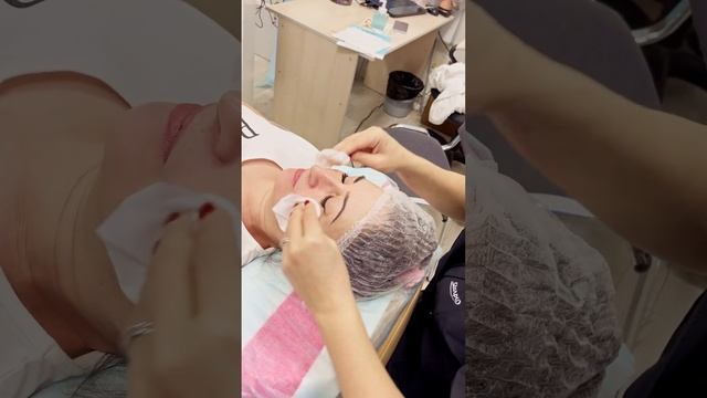 🔥Впечатляющий результат! Процедура RF-лифтинга на апп смотреть онлайн