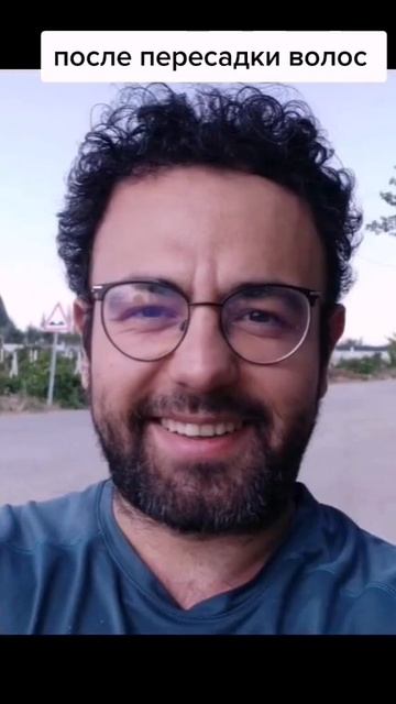 Пересадка волос в Турции | Результат после пересадки в смотреть онлайн