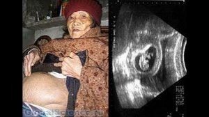 ШОК! 92-летняя  БАБУШКА была беременной 60 лет/Любопытные факты