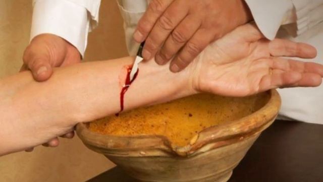 УЖАСЫ МЕДИЦИНЫ  СТРАШНЫЕ СПОСОБЫ ЛЕЧЕНИЯ, о которых лучше забыть навсегда   Интересные факты