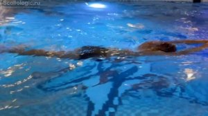 3 упражнения для бассейна при сколиозе