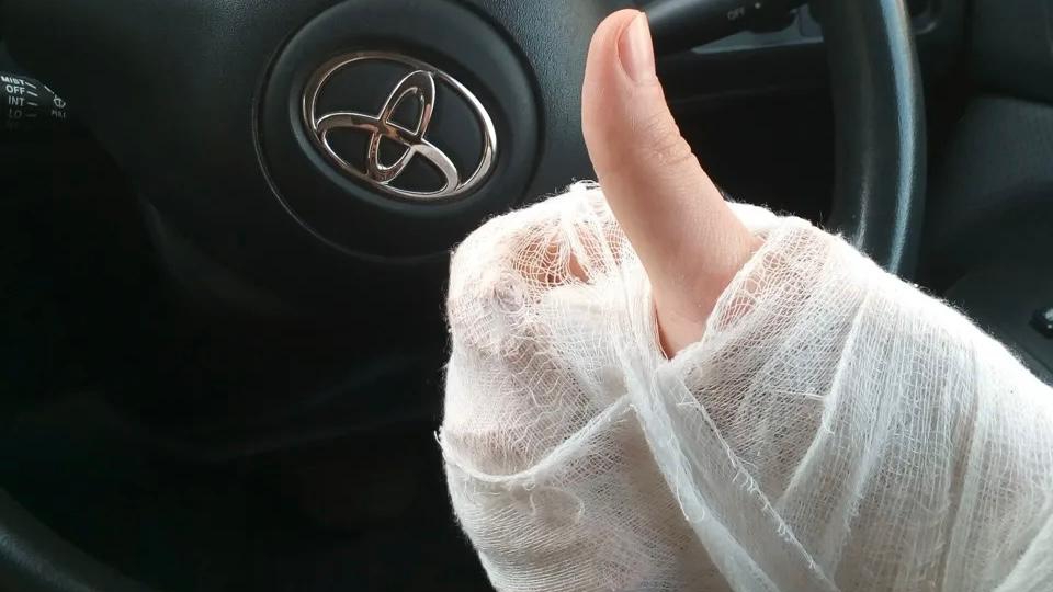 Эксперт рассказал можно ли управлять автомобилем со сломанной рукой в гипсе смотреть онлайн