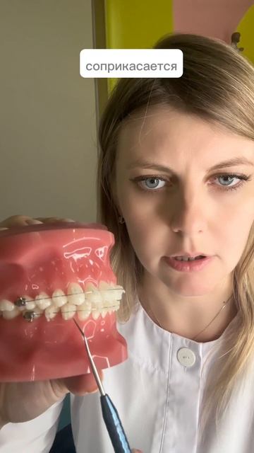 Какой должен быть правильный прикус?