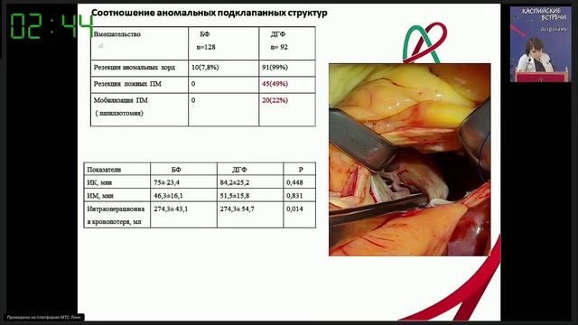 гипертрофическая кардиомиопатия смотреть онлайн