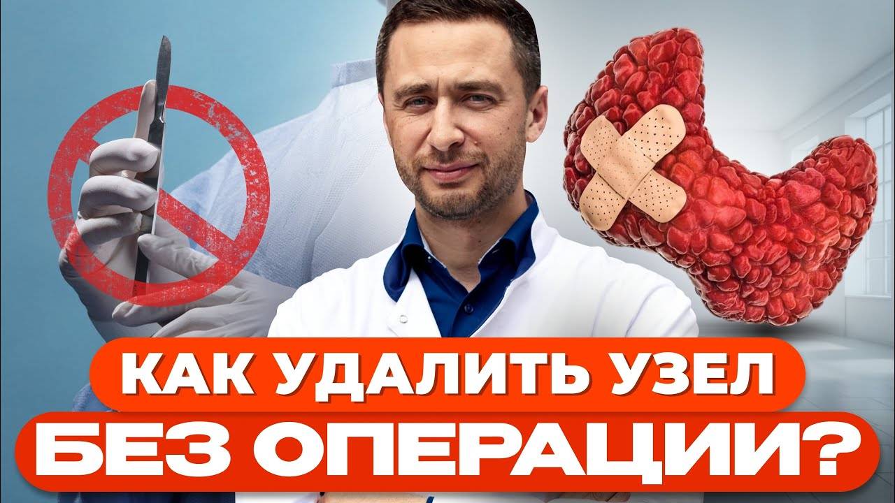 Как удалить узел щитовидной железы без операции? Всё о термоабляции!