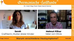 Сухая кожа, #шелушение, #покраснение, #сыпь, #волдырь, #экзема,