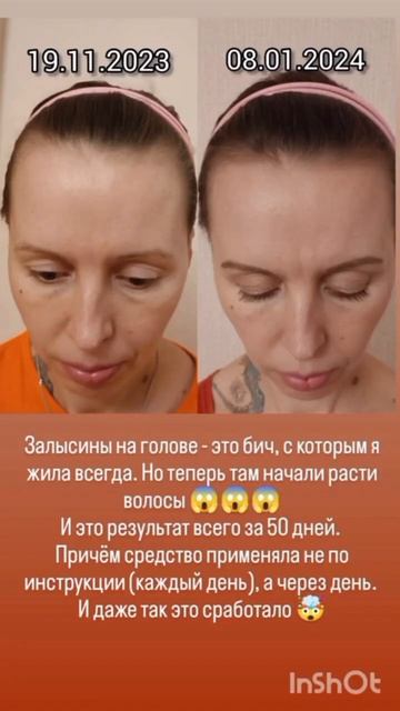 Сыворотка для роста волос #siberianwellness #отзыв  #сибирское?