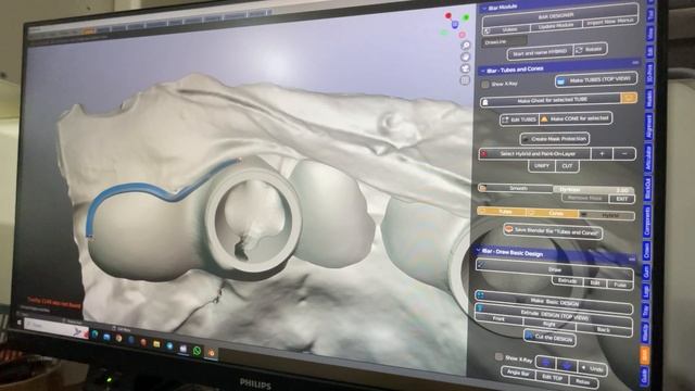 Blender4dental, B4D, iBAR, Blender, моделировка балки в блендере (част смотреть онлайн