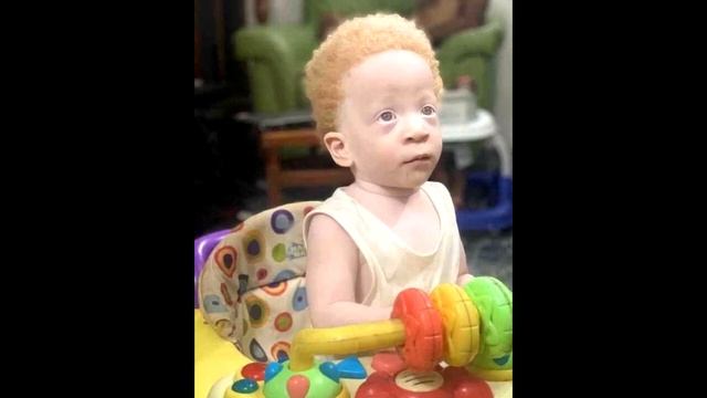 такого никто не ОЖИДАЛ: девушка родила близнецов, но люди не ВЕРЯТ, что оба мальчика её