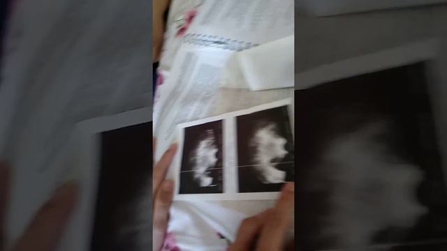 Отзыв о телесном процессе МТВСС  MTVSS  Access Consciousness фасилитатор  Евгения Дьякова