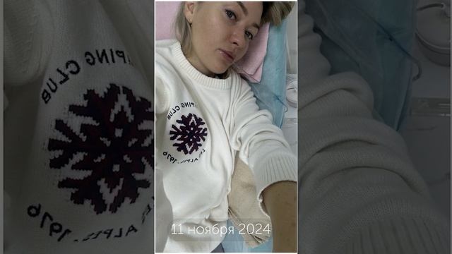 Моя история борьбы с отеками⚡️#shorts #какизбавиться #отеки