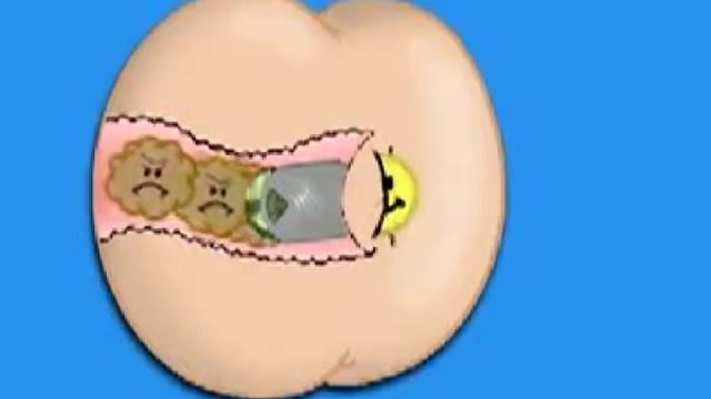 Глейд антипердин.mp4 смотреть онлайн