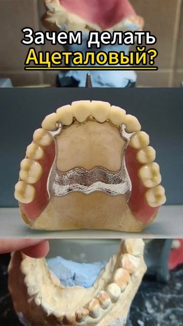 У кого ТАКОЙ был?  #съёмныепротезы #зубныепротезы #протезирование #протезирование #стоматологияспб