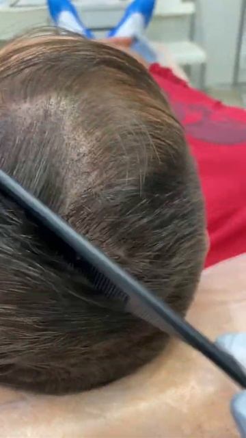 Трихопигментация головы #shorts #трихопигментация #косметолог