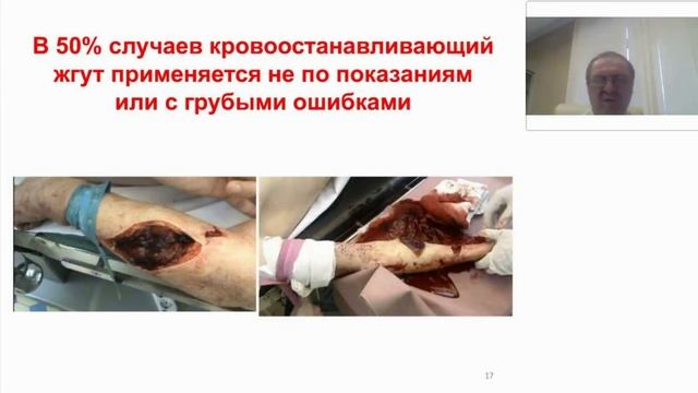 Самохвалов Игорь Маркеллович смотреть онлайн