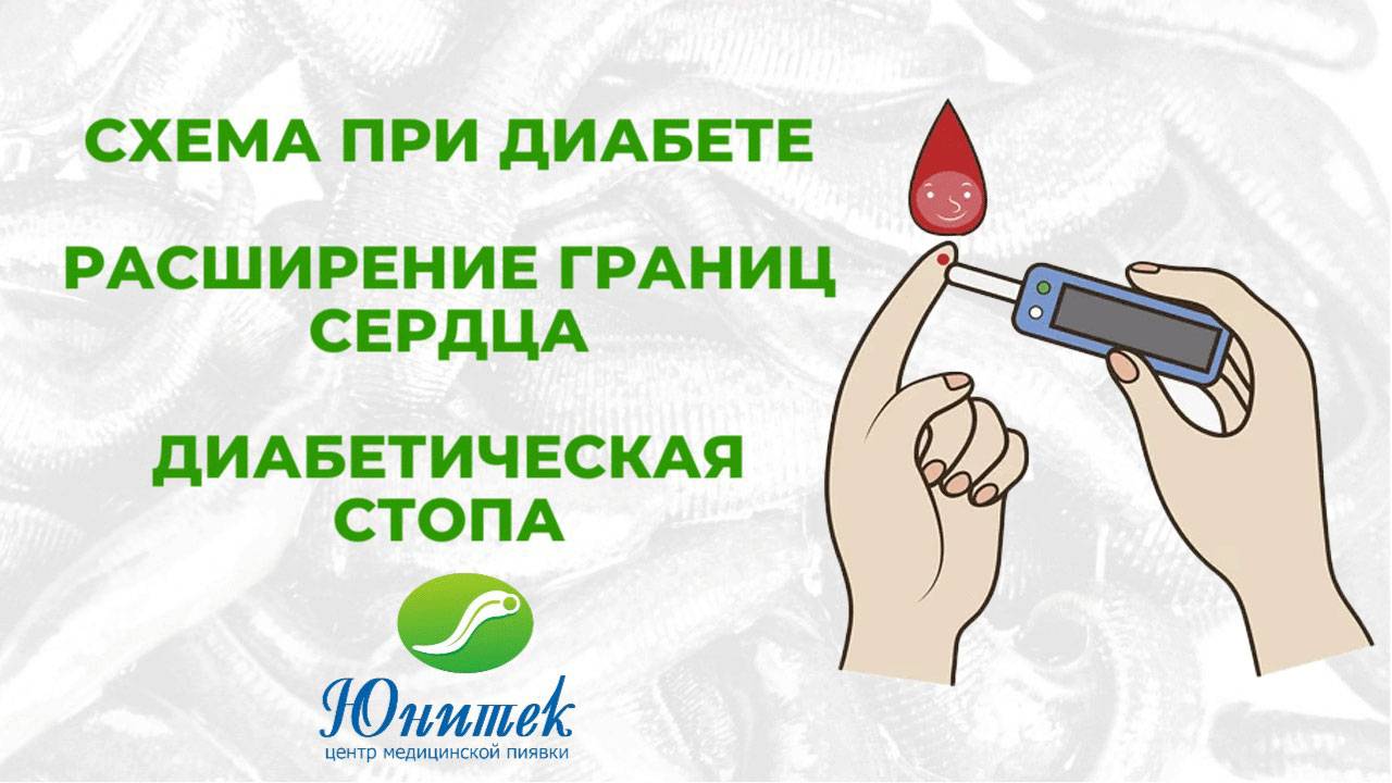 Сахарный диабет, расширение границ сердца, диабетическая стопа