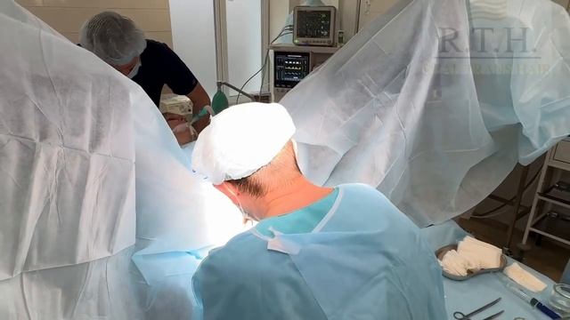 Пластика малых половых губ или лабиопластика