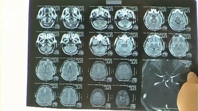 «Медичний журнал» запрошує на ефір тих, хто прагне бути здоровим смотреть онлайн