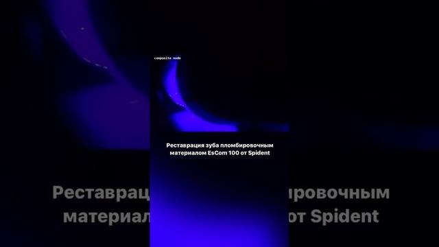 РЕСТАВРАЦИЯ ЗУБА С ГЛУБОКИМ КАРИЕСОМ с EsCom 100  - Киямова Татьяна (стоматолог-терапевт)