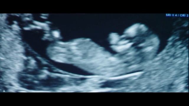 "Еврокино" : "Добро пожаловать на юг 2" смотреть онлайн