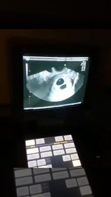 ТРОЙНЯААА!😱😍В ЕСТЕСТВЕННОМ цикле!