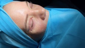 Круговая блефаропластика верхних и нижних век БЕЗ БОЛ