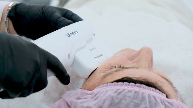 СМАС-лифтинг Лифтера в Ижевске смотреть онлайн