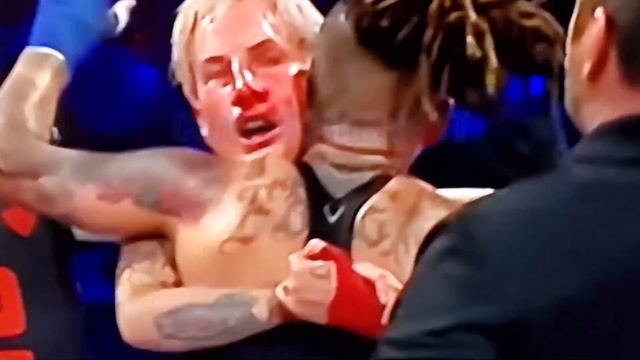 Когда ищешь бокс, а находишь бой без перчаток 🥊🩸 смотреть онлайн