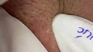 Аккуратная чистка кожи лица