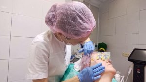 армирование лица канюлей жидкими нитями #косметологи?