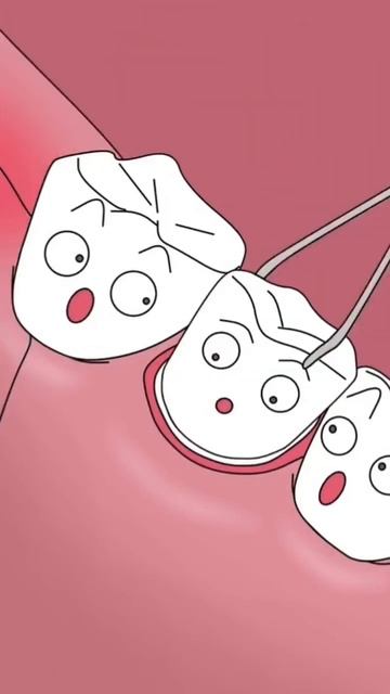 Пересадка зуба #shorts