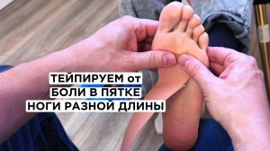 Тейпируемся при Боли в пятке и пяточной шпоре, для более комфортной ходьбы